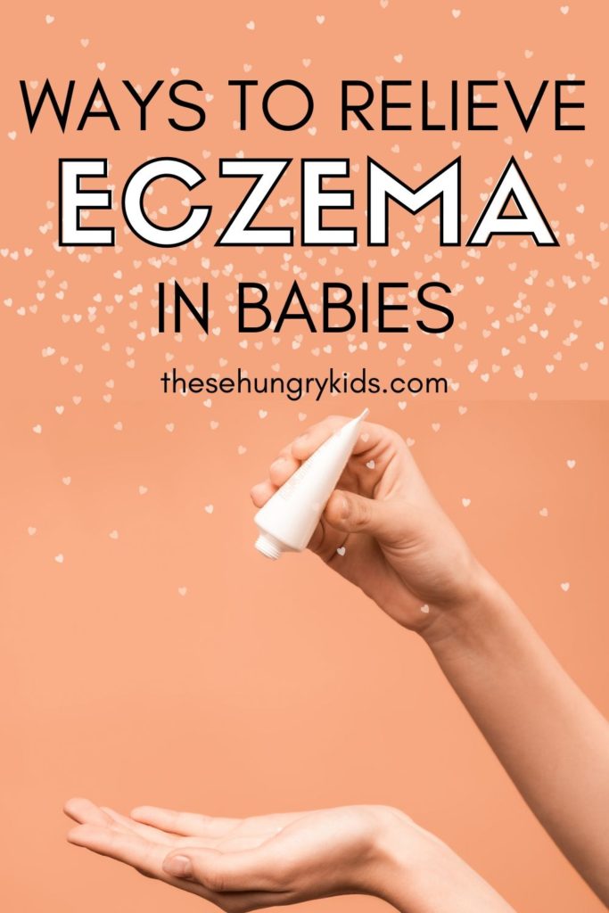 Everything you need to know about relieving eczema in your baby! From different remedies and tricks to try, you can get your baby relief in no time!