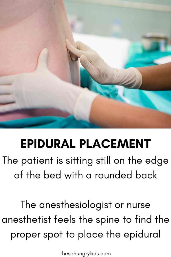 the proper position to get an epidural placed